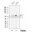 Western blot analysis of extracts from HeLa cells?, using OSBPL2 Antibody. The lane on the left was treated with blocking peptide.