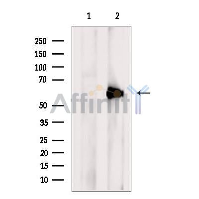 Western blot analysis of extracts from NIH/3T3 cells, using PACSIN2 Antibody. The lane on the left was treated with blocking peptide.