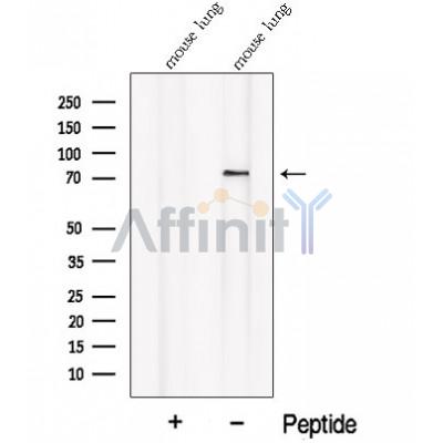 Western blot analysis of extracts from Mouse lung tissue, using PALMD Antibody. The lane on the left was treated with blocking peptide.