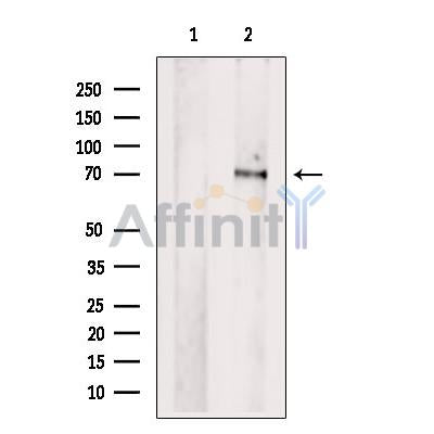 Western blot analysis of extracts from Mouse liver tissue, using PCK2 Antibody. The lane on the left was treated with blocking peptide.