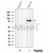 PCSK9 Antibody