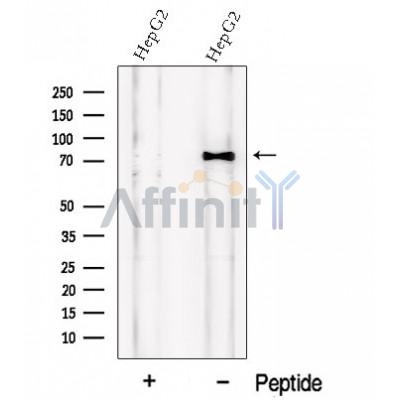 PCSK9 Antibody