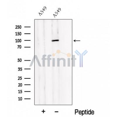 Western blot analysis of extracts from A549 cells, using PDE6B Antibody. The lane on the left was treated with blocking peptide.