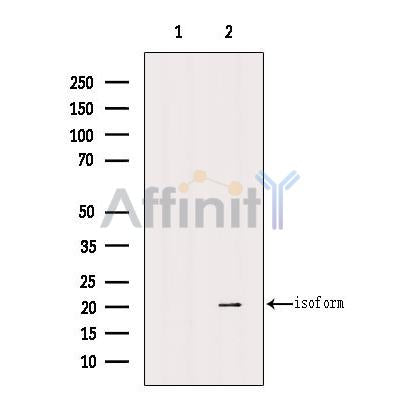 Western blot analysis of extracts from HEK-293 cells, using PHD3 Antibody. The lane on the left was treated with blocking peptide.