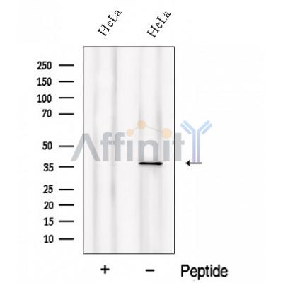 Western blot analysis of extracts from HeLa cells, using PIH1D1 Antibody. The lane on the left was treated with blocking peptide.