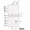 Western blot analysis of extracts from HEK-293 cells?, using PLA2G12A Antibody. The lane on the left was treated with blocking peptide.