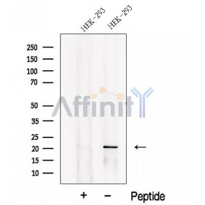 Western blot analysis of extracts from HEK-293 cells?, using PLA2G12A Antibody. The lane on the left was treated with blocking peptide.