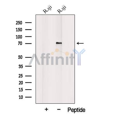 Western blot analysis of extracts from Raji cells, using PLAGL2 Antibody. The lane on the left was treated with blocking peptide.