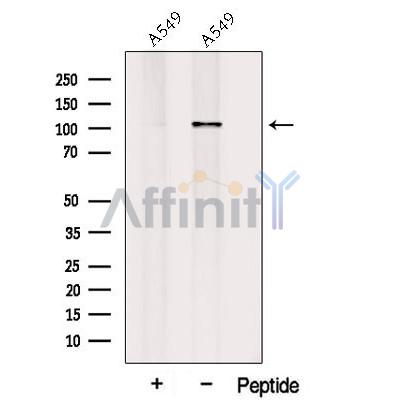Western blot analysis of extracts from A549 cells, using PLEKHG5 Antibody. The lane on the left was treated with blocking peptide.