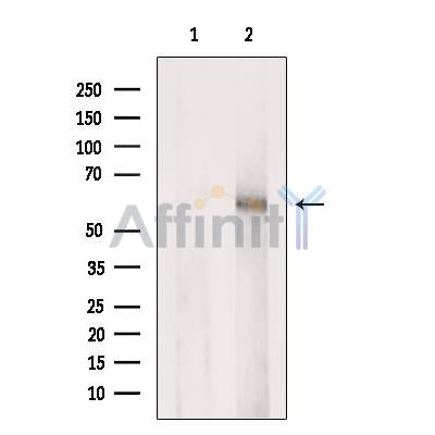 Western blot analysis of extracts from HEK-293 cells, using POPDC3 Antibody. The lane on the left was treated with blocking peptide.