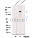 Western blot analysis of extracts from Mouse liver tissue?, using PPARGC1B Antibody. The lane on the left was treated with blocking peptide.