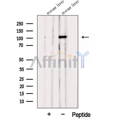 Western blot analysis of extracts from Mouse liver tissue?, using PPARGC1B Antibody. The lane on the left was treated with blocking peptide.
