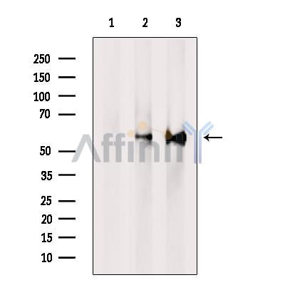 Western blot analysis of extracts from HEK-293 cells, using PPP3CB Antibody. The lane on the left was treated with blocking peptide.