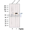 Western blot analysis of extracts from Mouse testis tissue, using PPP5C Antibody. The lane on the left was treated with blocking peptide.