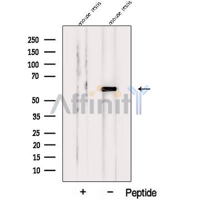 Western blot analysis of extracts from Mouse testis tissue, using PPP5C Antibody. The lane on the left was treated with blocking peptide.