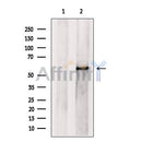 Western blot analysis of extracts from Raji cells, using PRPF4 Antibody. The lane on the left was treated with blocking peptide.