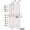 Western blot analysis of extracts from Mouse  brain, using PRRT1 Antibody. The lane on the left was treated with blocking peptide.