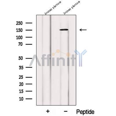 Western blot analysis of extracts from Human placenta tissue, using PRUNE2 Antibody. The lane on the left was treated with blocking peptide.