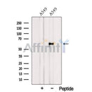 Western blot analysis of extracts from A549 cells, using PSMC1 Antibody. The lane on the left was treated with blocking peptide.