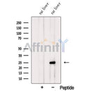 Western blot analysis of extracts from Rat liver tissue, using PSPH Antibody. The lane on the left was treated with blocking peptide.
