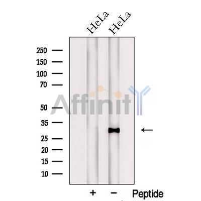 Western blot analysis of extracts from HeLa cells, using PTGES2 Antibody. The lane on the left was treated with blocking peptide.