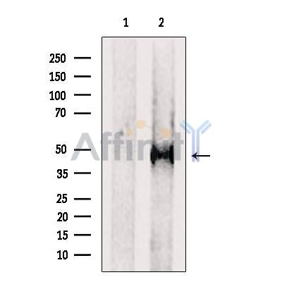 Western blot analysis of extracts from HeLa cells, using PTPRR Antibody. The lane on the left was treated with blocking peptide.