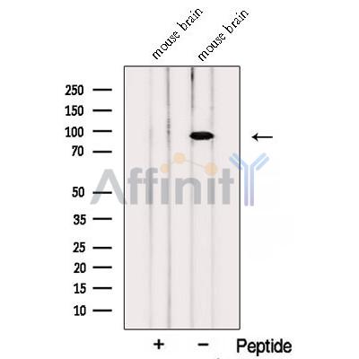Western blot analysis of extracts from Mouse brain tissue, using PTPRS Antibody. The lane on the left was treated with blocking peptide.