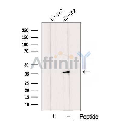 Western blot analysis of extracts from Rat  liver, using QKI Antibody. The lane on the left was treated with blocking peptide.