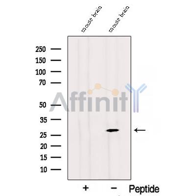 Western blot analysis of extracts from Rat  brain, using RAB3C Antibody. The lane on the left was treated with blocking peptide.