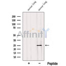 Western blot analysis of extracts from Rat  brain, using RABL3 Antibody. The lane on the left was treated with blocking peptide.