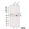 Western blot analysis of extracts from Hela, using RARG Antibody. The lane on the left was treated with blocking peptide.