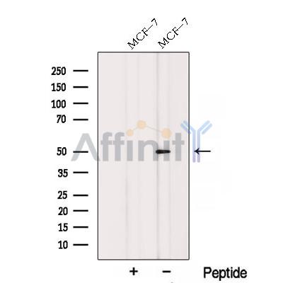 Western blot analysis of extracts from Hela, using RARG Antibody. The lane on the left was treated with blocking peptide.