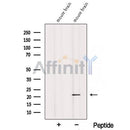 Western blot analysis of extracts from Mouse brain tissue?, using REEP1 Antibody. The lane on the left was treated with blocking peptide.