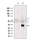 Western blot analysis of extracts from Mouse liver tissue?, using RGN/SMP30 Antibody. The lane on the left was treated with blocking peptide.