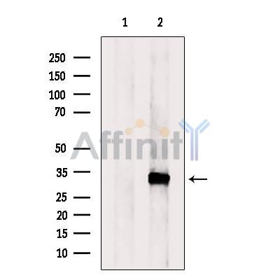 Western blot analysis of extracts from Mouse liver tissue?, using RGN/SMP30 Antibody. The lane on the left was treated with blocking peptide.