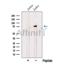 Western blot analysis of extracts from HepG2, using RLIM Antibody. The lane on the left was treated with blocking peptide.