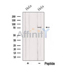 Western blot analysis of extracts from HeLa cells, using RMI1 Antibody. The lane on the left was treated with blocking peptide.