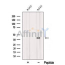 Western blot analysis of extracts from A549 cells, using RSPO3 Antibody. The lane on the left was treated with blocking peptide.
