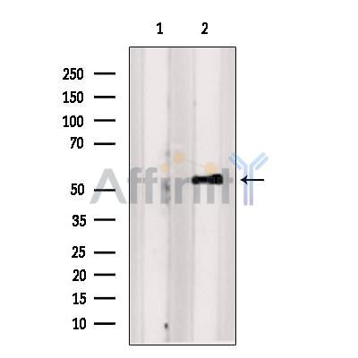 Western blot analysis of extracts from K-562 cells, using SAMSN1 Antibody. The lane on the left was treated with blocking peptide.