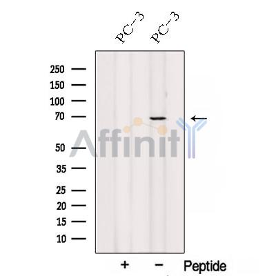 Western blot analysis of extracts from PC-3 cells, using SPATA7 Antibody. The lane on the left was treated with blocking peptide.