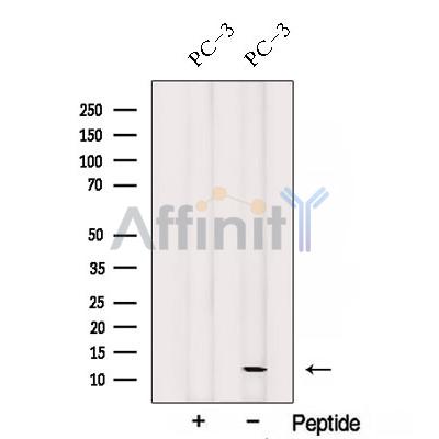 Western blot analysis of extracts from PC-3 cells, using SPCS1 Antibody. The lane on the left was treated with blocking peptide.