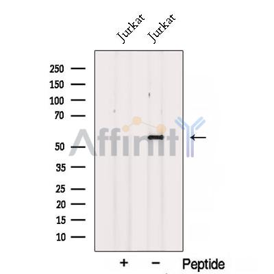 Western blot analysis of extracts from Jurkat cells, using SPTLC1 Antibody. The lane on the left was treated with blocking peptide.