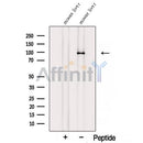Western blot analysis of extracts from Mouse liver tissue?, using STRA6 Antibody. The lane on the left was treated with blocking peptide.