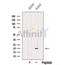 Western blot analysis of extracts from A549 cells, using SUB1 Antibody. The lane on the left was treated with blocking peptide.