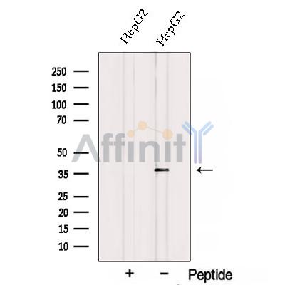 Western blot analysis of extracts from HepG2 cells, using TALDO1 Antibody. The lane on the left was treated with blocking peptide.