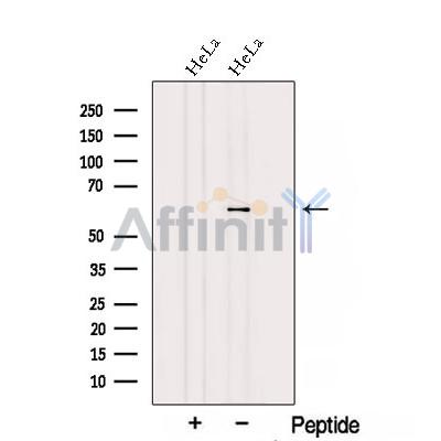 Western blot analysis of extracts from HeLa cells, using TBCE Antibody. The lane on the left was treated with blocking peptide.