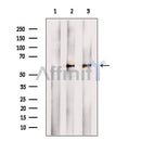 Western blot analysis of extracts from A375 cells, using TCN2 Antibody. The lane on the left was treated with blocking peptide.