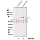 Western blot analysis of extracts from Hela, using TDRKHspecific Antibody. The lane on the left was treated with blocking peptide.