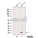 Western blot analysis of extracts from various samples, using TIMM13 Antibody.
 Lane 1: B16F10 treated with blocking peptide;
 Lane 2: B16F10;
 Lane 3: Rat  brain;
 Lane 4: 293;
 Lane 5: Myeloma cells.