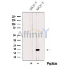 Western blot analysis of extracts from MCF-7 cells, using TIMM17A Antibody. The lane on the left was treated with blocking peptide.